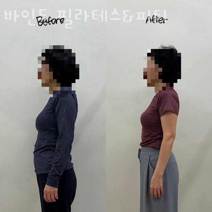 바인드 필라테스 이미지