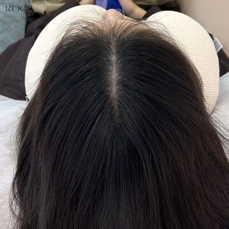 로기SMP 이미지
