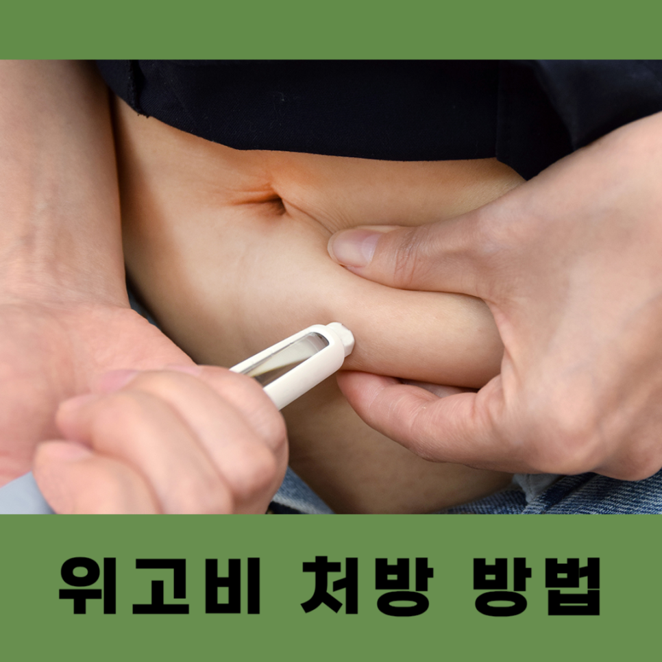 스카이쁘아뜨의원 이미지