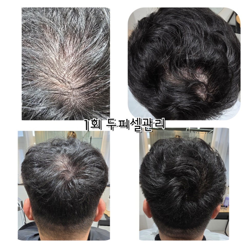 닥터시스 셀클럽 이미지
