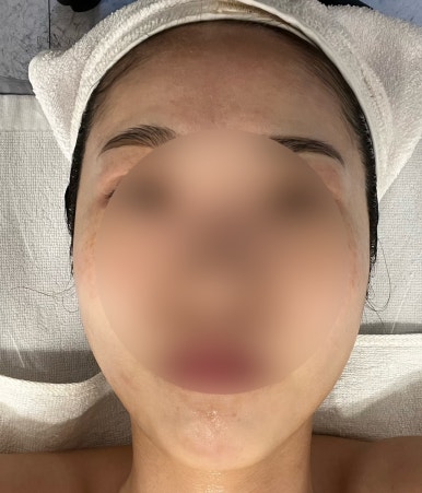뷰티인시아 에스테틱 이미지