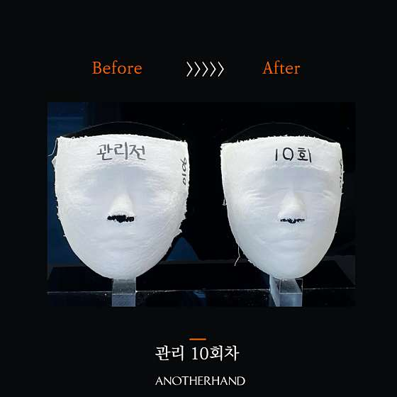 논현피부관리 이미지