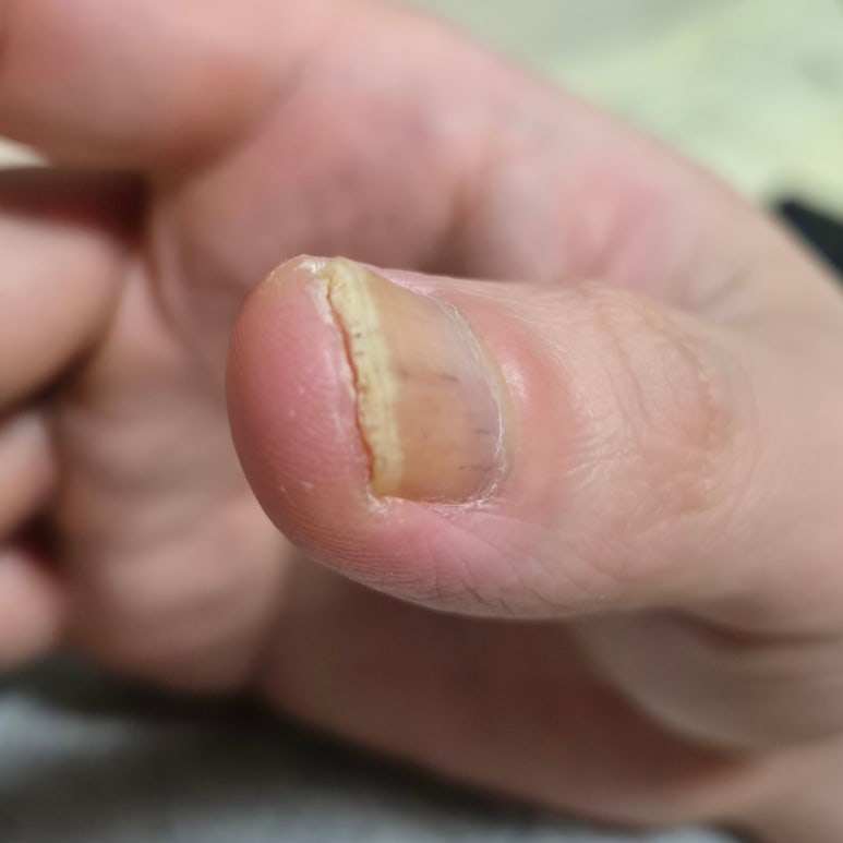 바른메디케어 이미지