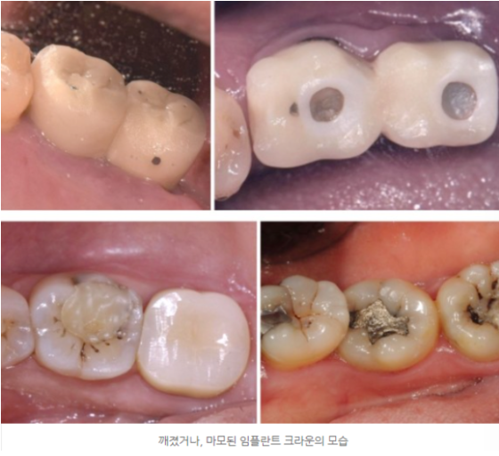 오부부치과 이미지