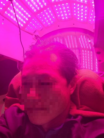 탈모케어존부산 이미지