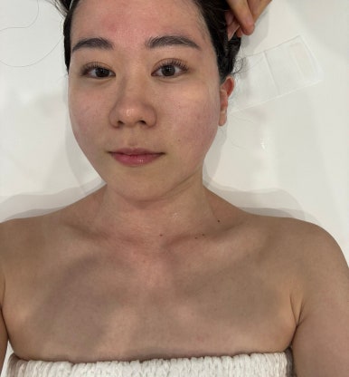 더케어에스테틱 이미지