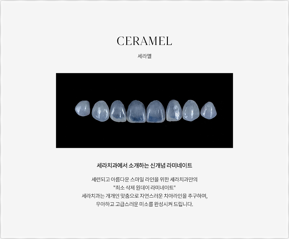 세라덴토 이미지