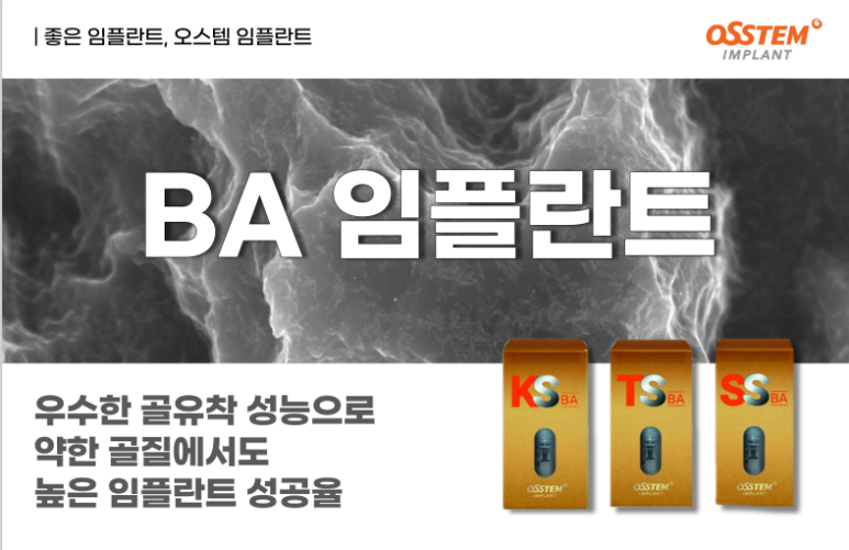 연세윤치과 이미지
