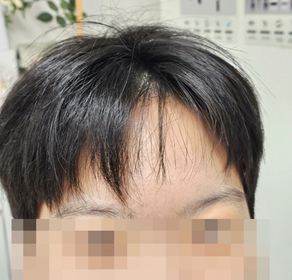 보니움 이미지
