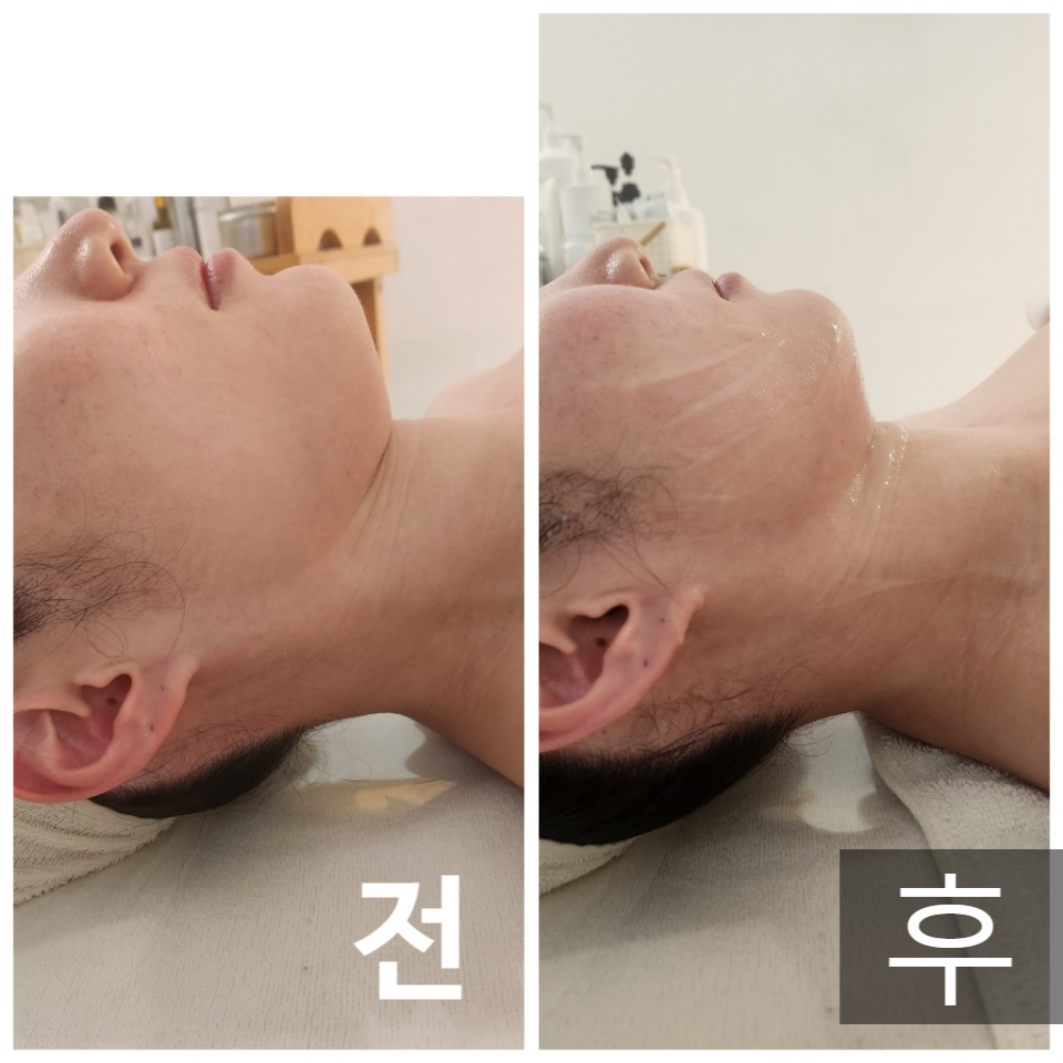 더예쁨에스테틱 이미지