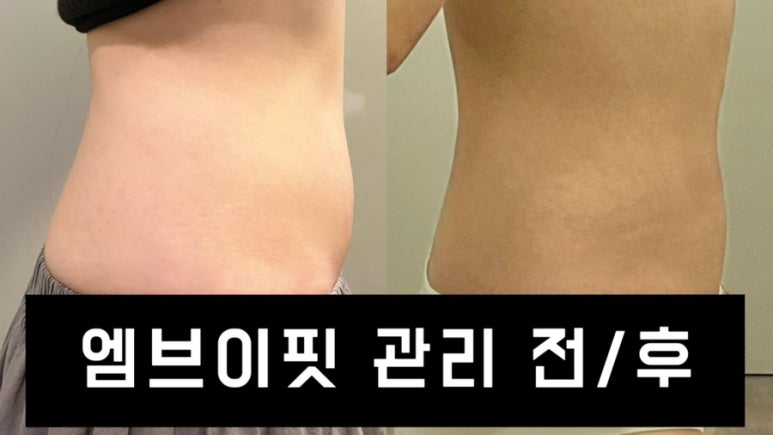 엠브이핏 이미지