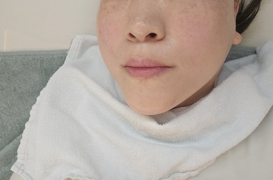 색소랩 이미지