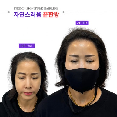 잉크본 이미지