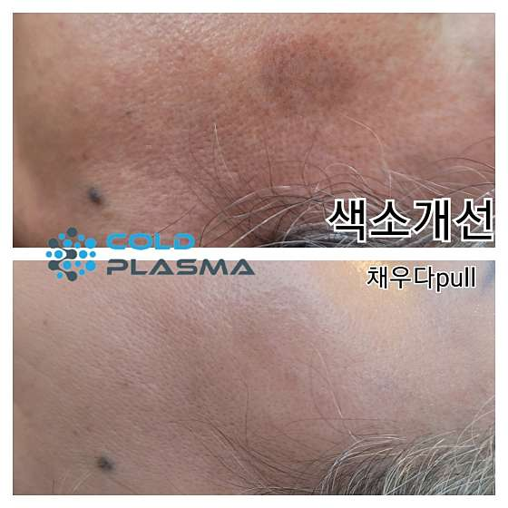 채우다pull 이미지