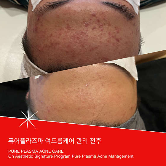 온 에스테틱(수원점) 이미지