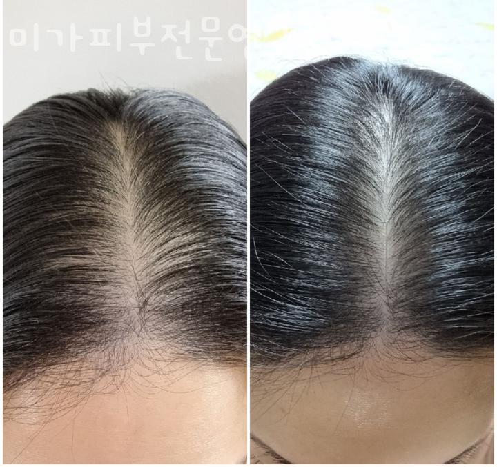 미가피부전문연구소 이미지