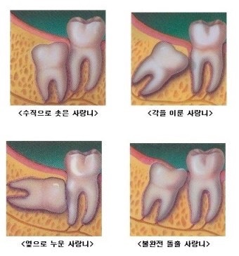 수성사랑니치과의원 이미지