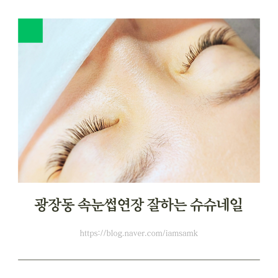 슈슈네일 이미지
