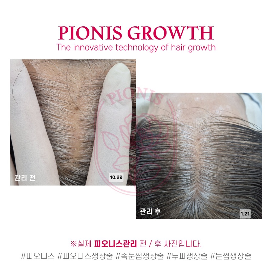 피오케이 이미지