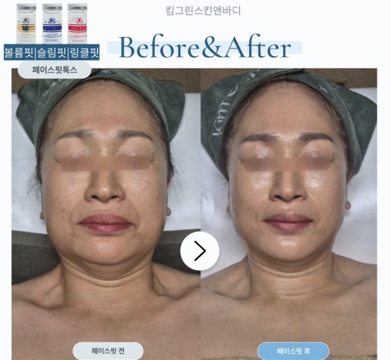 선 피부앤바디 이미지