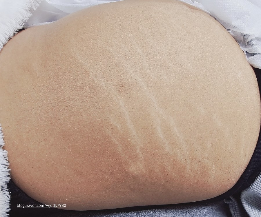 천안탈모튼살스킨커버아카데미 이미지