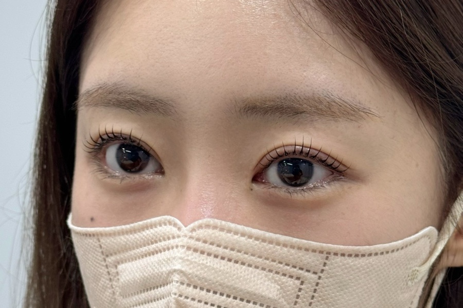 멜트브로우 이미지