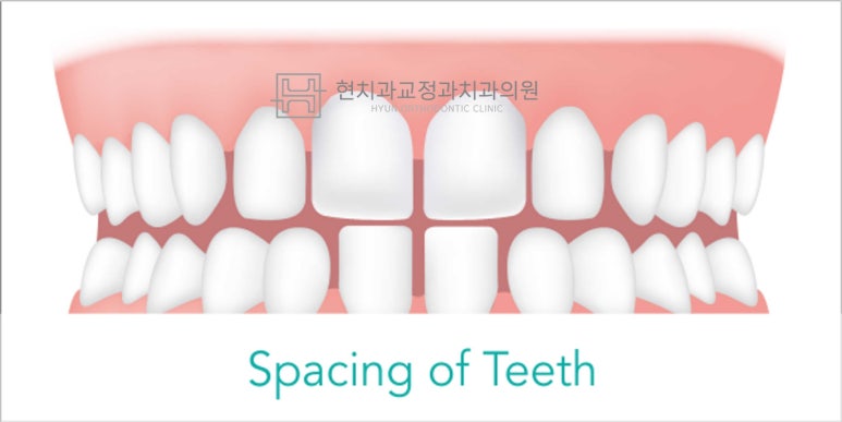 현치과교정과치과의원 이미지
