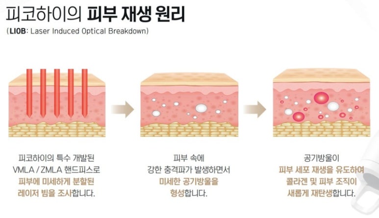 피코 이미지