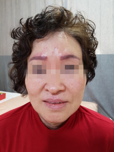 비벌리스킨케어 이미지