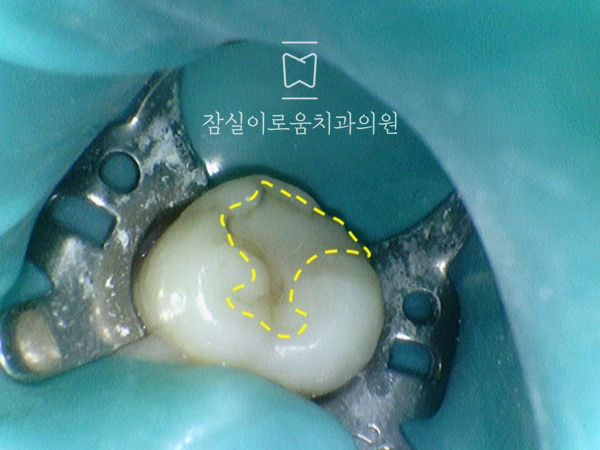 잠실이로움치과 이미지