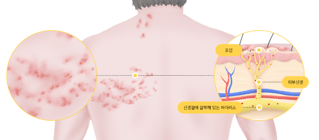 월배역바로정형외과 이미지