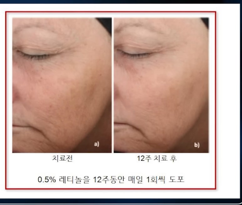로뎀스킨케어 이미지