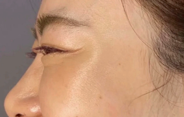피부만연예인 이미지