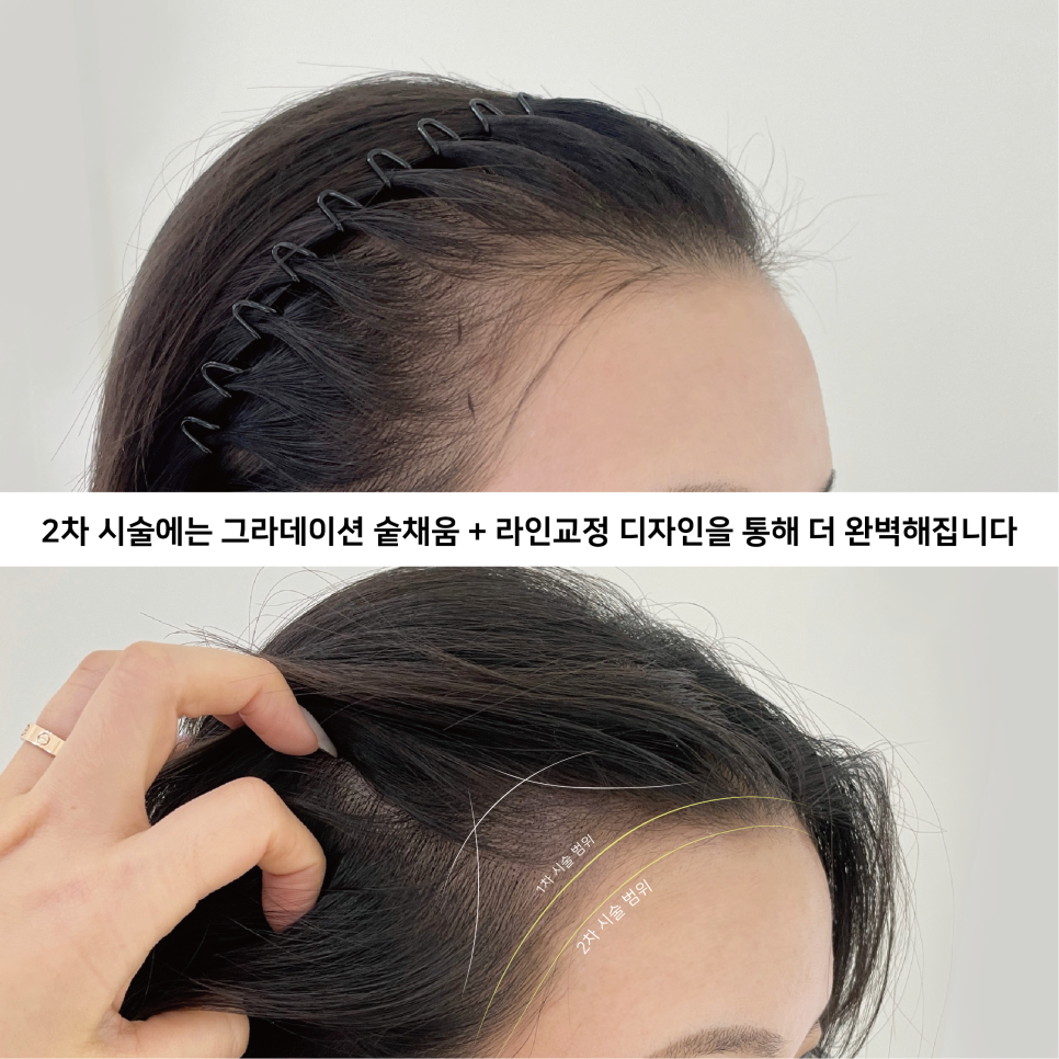 온 디프 이미지