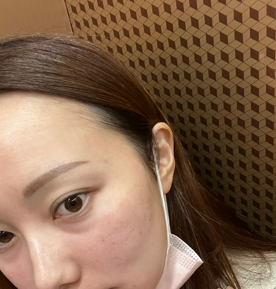 브로우원 이미지