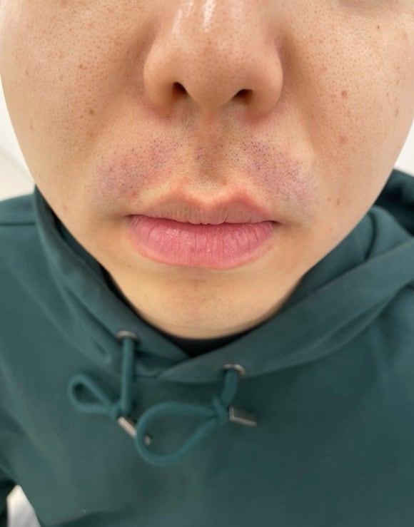 더블유피부과의원 이미지