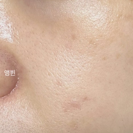 동일각 이미지