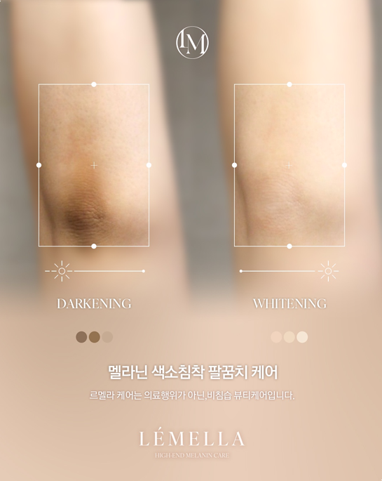 미르플랜 이미지