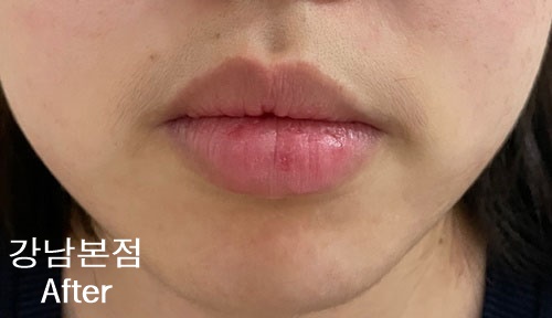 리유 이미지