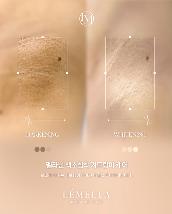 원플랜 이미지