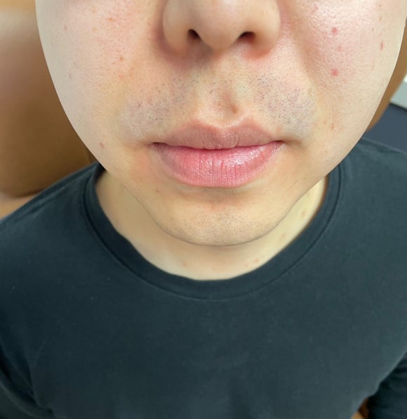 더블유피부과의원 이미지