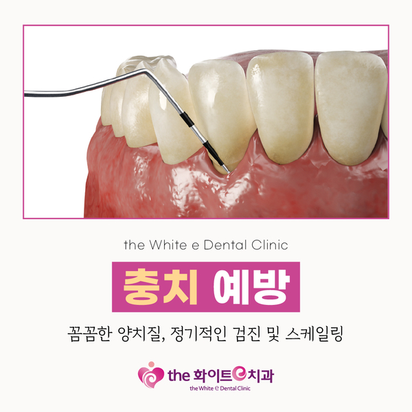 e-하나로치과 이미지