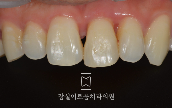 잠실이로움치과 이미지