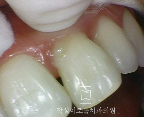 잠실이로움치과 이미지