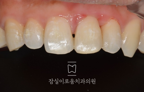 잠실이로움치과 이미지
