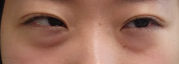 뷰티나쥬 이미지