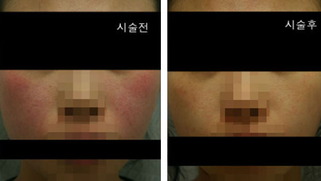 연세예피부과의원 이미지