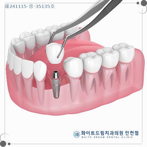 오늘하루치과의원 이미지