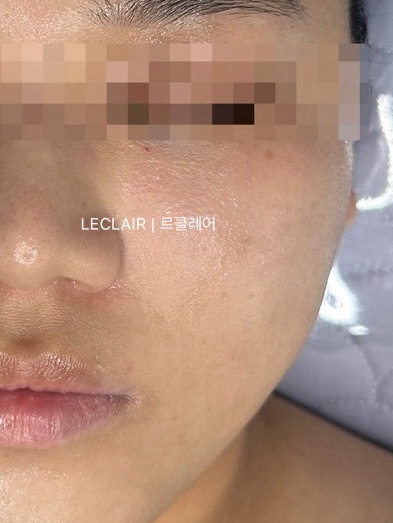 르클레어 이미지