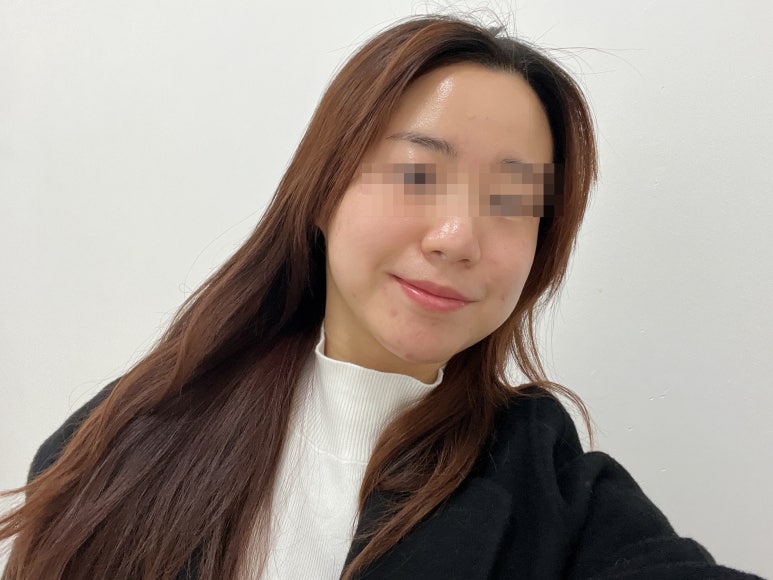 가림피부관리 이미지